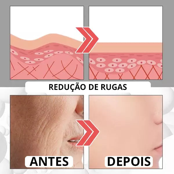 Botox Up Sérum Anti-Envelhecimento - LANÇAMENTO 2023