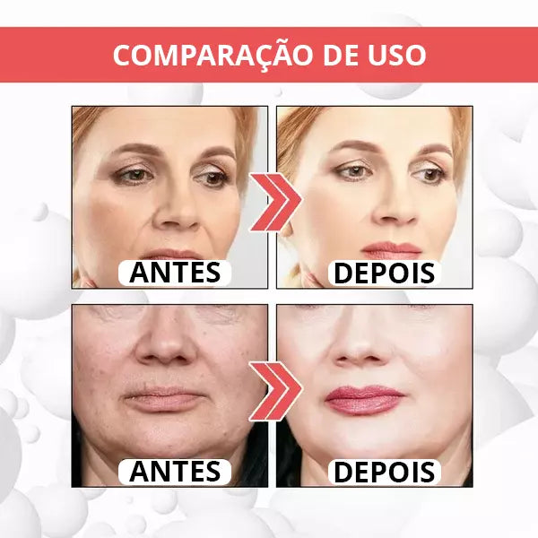 Botox Up Sérum Anti-Envelhecimento - LANÇAMENTO 2023