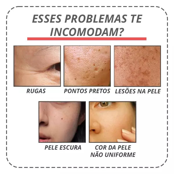 Botox Up Sérum Anti-Envelhecimento - LANÇAMENTO 2023